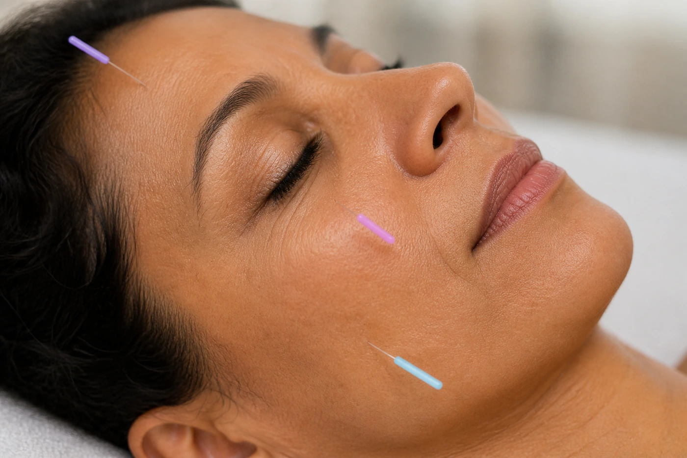 Relaxing acupuncture session for menopause support in Cape Town