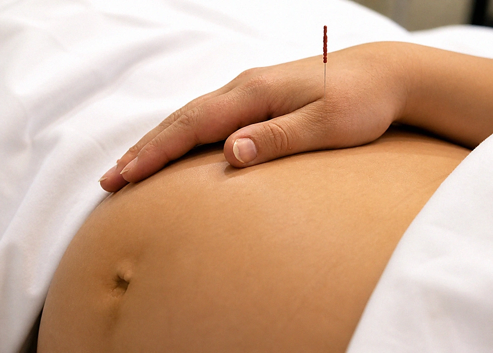 Pregnancy acupuncture and birth support in Cape Town
